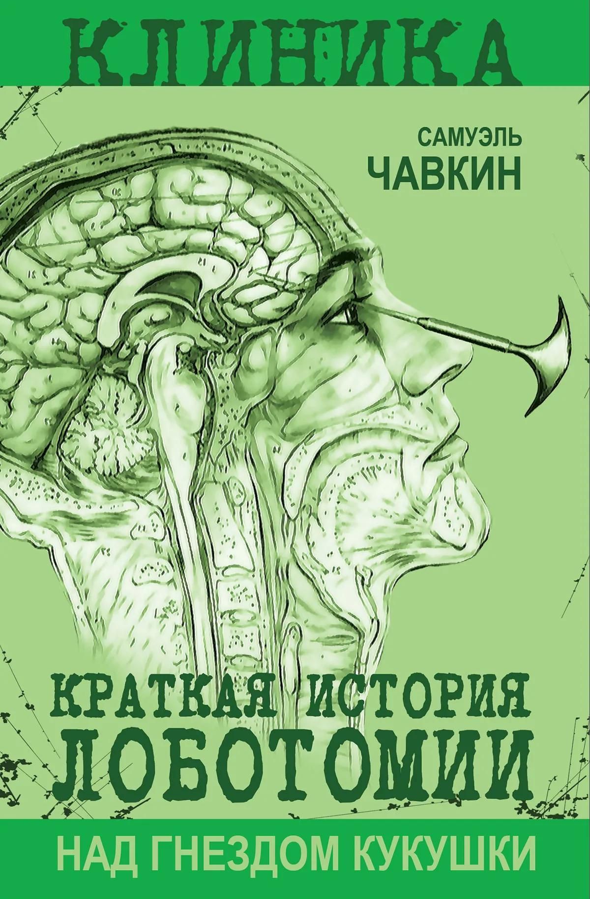 Самуэль Чавкин: Над гнездом кукушки. Краткая история лоботомии