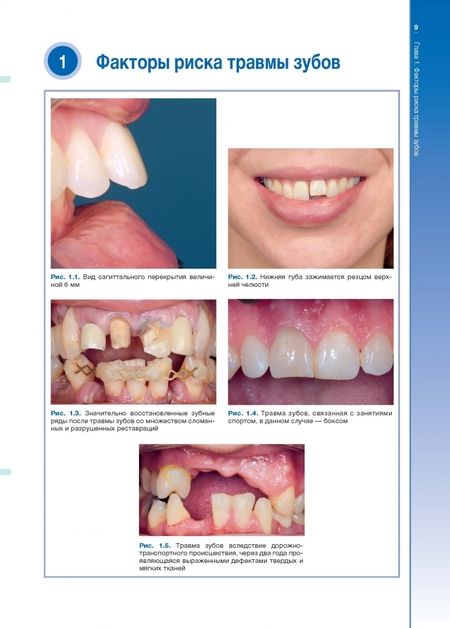 Фотография книги "Алани, Кэлверт: Травмы зубов. Наглядное пособие"