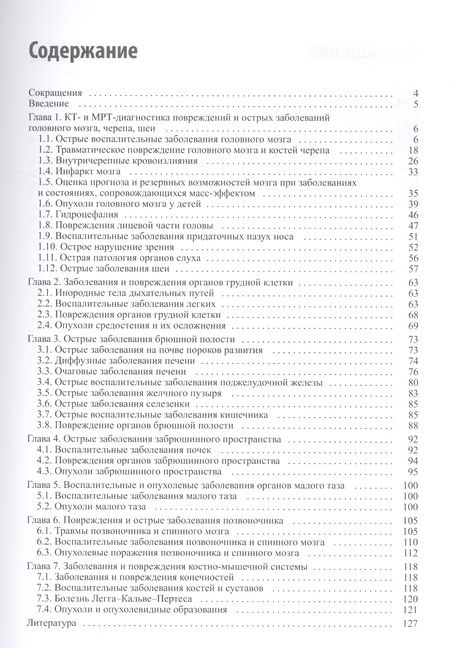 Фотография книги "Александр Холин: КТ и МРТ при неотложных состояниях у детей"