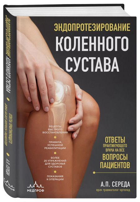 Фотография книги "Андрей Середа: Эндопротезирование коленного сустава: ответы практикующего врача на все вопросы пациентов"