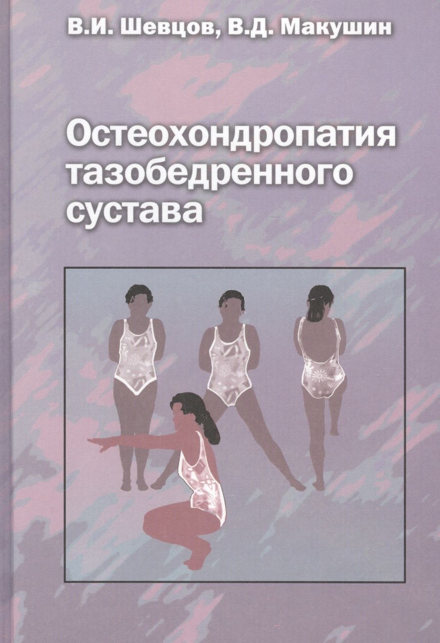 Обложка книги "Георгий Шевцов: Остеохондропатия тазобедренного сустава. Руководство для врачей"