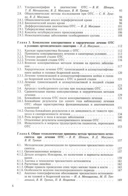 Фотография книги "Георгий Шевцов: Остеохондропатия тазобедренного сустава. Руководство для врачей"