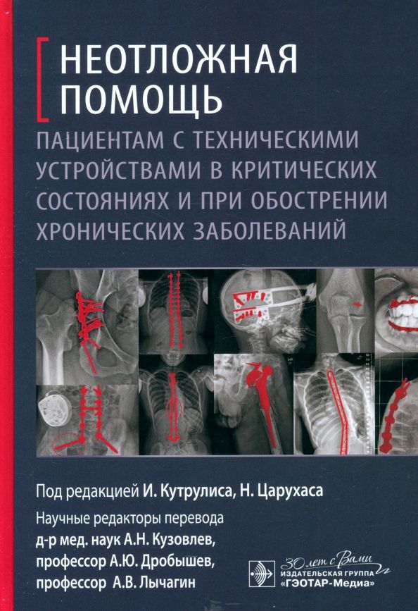 Обложка книги "Кутрулис, Царухас: Неотложная помощь пациентам с техническими устройствами в критических состояниях"
