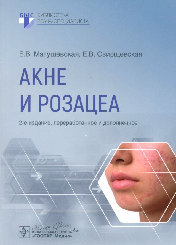 Обложка книги "Матушевская, Свирщевская: Акне и розацеа"