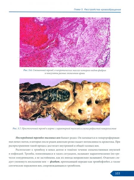 Фотография книги "Насыров, Иванов, Аничков: Патологическая анатомия. Общий курс. Учебник для медицинских вузов"