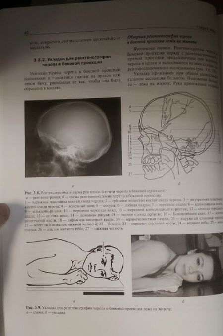 Фотография книги "Ростовцев, Братникова, Корнеева: Атлас рентгеноанатомии и укладок. Руководство для врачей"