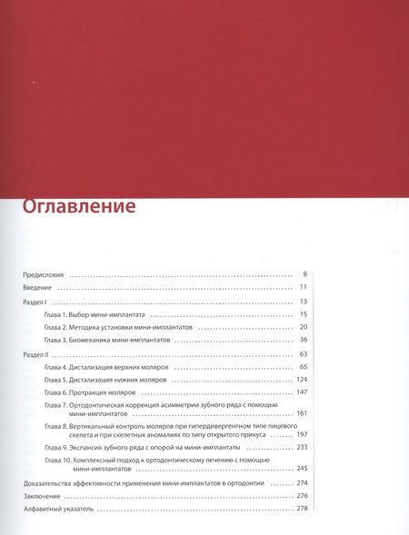 Фотография книги "Скандер Эллуз: Мини-имплантаты. Ортодонтия будущего."