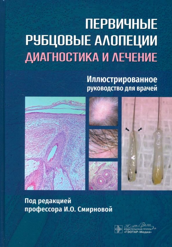 Обложка книги "Смирнова, Бессалова, Волков: Первичные рубцовые алопеции. Диагностика и лечение. Иллюстрированное руководство для врачей"