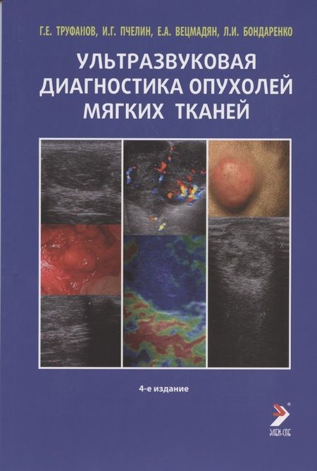 Фотография книги "Труфанов: Ультразвуковая диагностика опухолей мягких тканей"