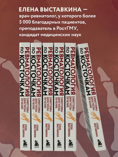 Фотография книги "Выставкина: Ревматология по косточкам. Симптомы, диагнозы, лечение"