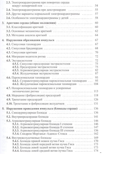 Дощицин Леонидович: Руководство по практической электрокардиографии