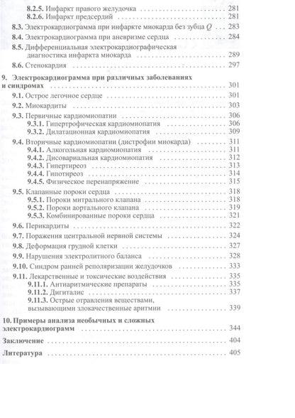 Дощицин Леонидович: Руководство по практической электрокардиографии