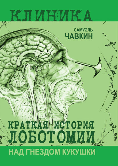 Самуэль Чавкин: Над гнездом кукушки. Краткая история лоботомии
