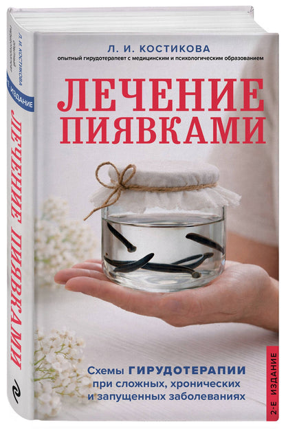 Любовь Костикова: Лечение пиявками. Схемы гирудотерапии при сложных, хронических и запущенных заболеваниях