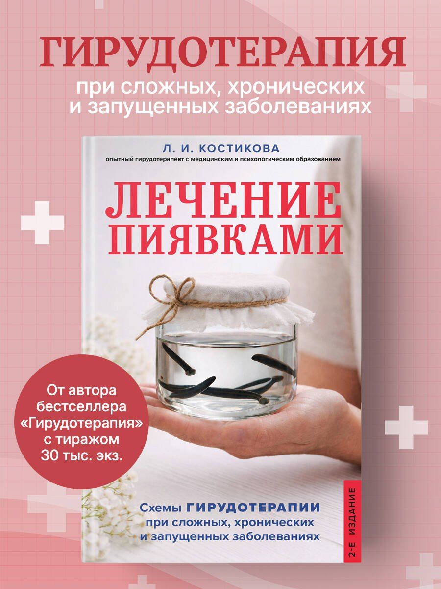 Любовь Костикова: Лечение пиявками. Схемы гирудотерапии при сложных, хронических и запущенных заболеваниях