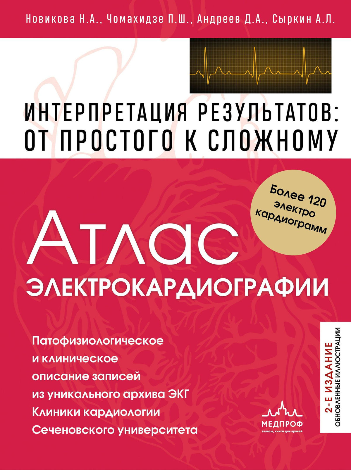 Петр Чомахидзе: Атлас электрокардиографии. Интерпретация результатов: от простого к сложному. 2-е издание
