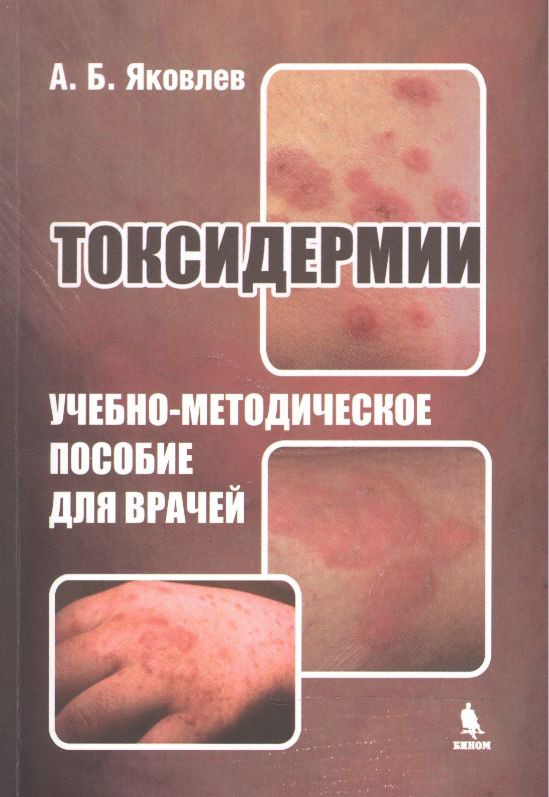 Алексей Яковлев: Токсидермии. Учебно-методическое пособие для врачей