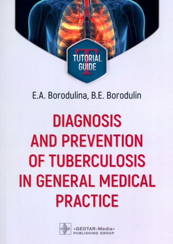 Елена Бородулина: Diagnosis and prevention of tuberculosis in general medical practice. Tutorial guide