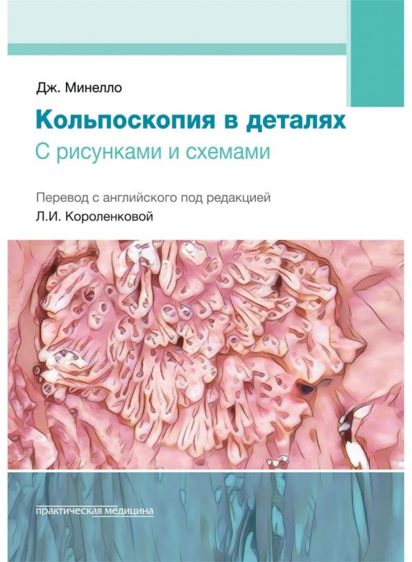Джованни Минелло: Кольпоскопия в деталях. С рисунками и схемами