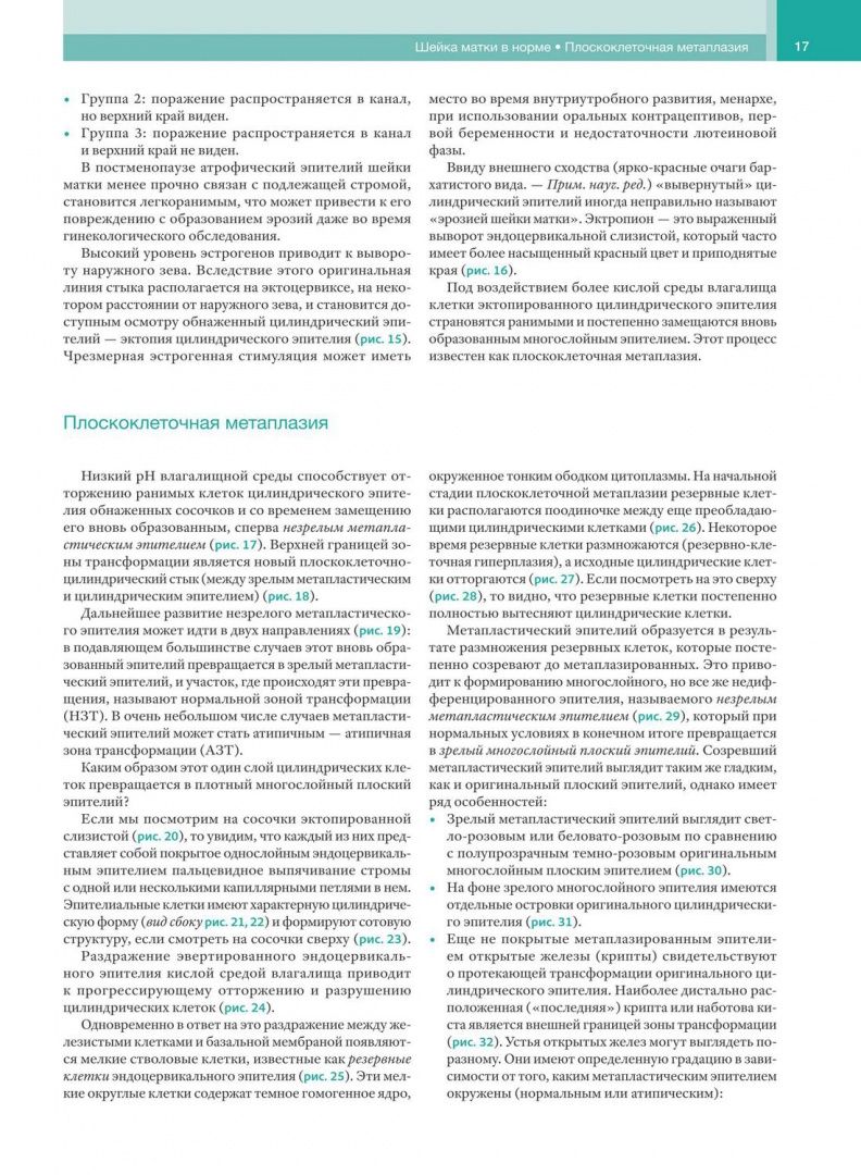 Джованни Минелло: Кольпоскопия в деталях. С рисунками и схемами