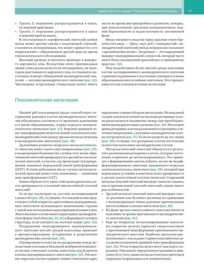 Джованни Минелло: Кольпоскопия в деталях. С рисунками и схемами