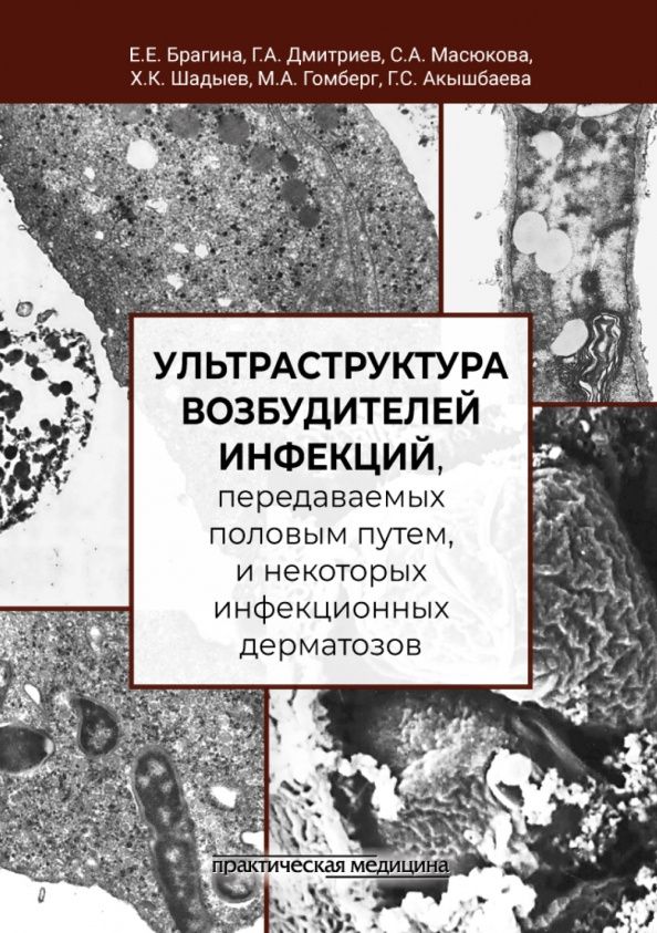 Елизавета Брагина: Ультраструктура возбудителей инфекций, передаваемых половым путем