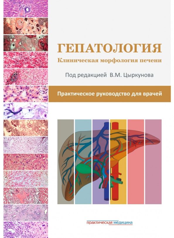 Николай Прокопчик: Гепатология. Клиническая морфология печени. Практическое руководство для врачей