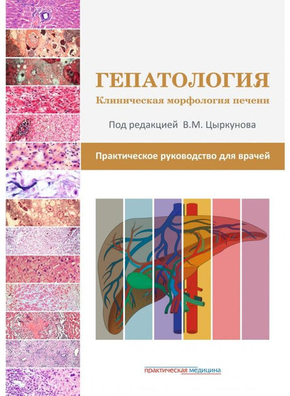 Николай Прокопчик: Гепатология. Клиническая морфология печени. Практическое руководство для врачей