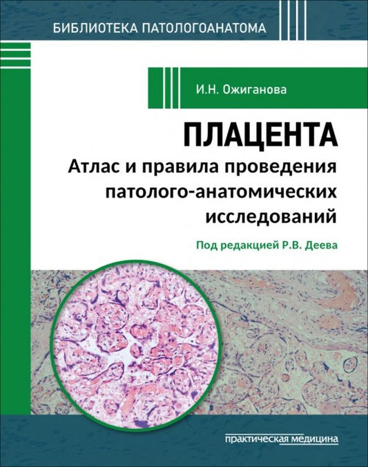 Ирина Ожиганова: Плацента. Атлас и правила проведения патолого-анатомических исследований