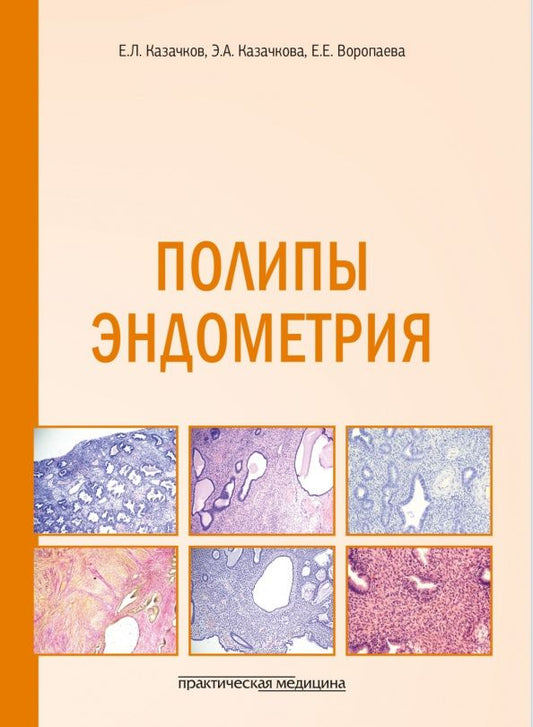 Полипы эндометрия. Учебное пособие