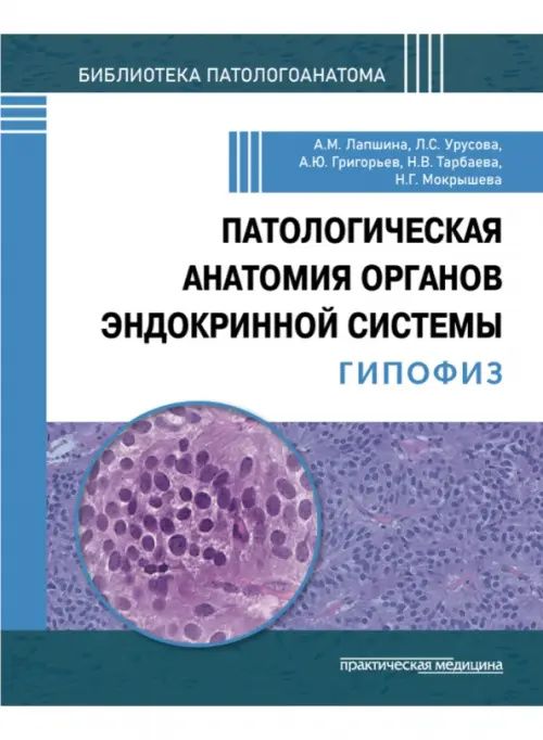 Анастасия Лапшина: Патологическая анатомия органов эндокринной системы. Гипофиз