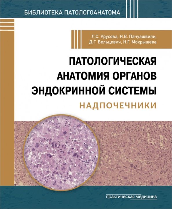 Дмитрий Бельцевич: Патологическая анатомия органов эндокринной системы. Надпочечники