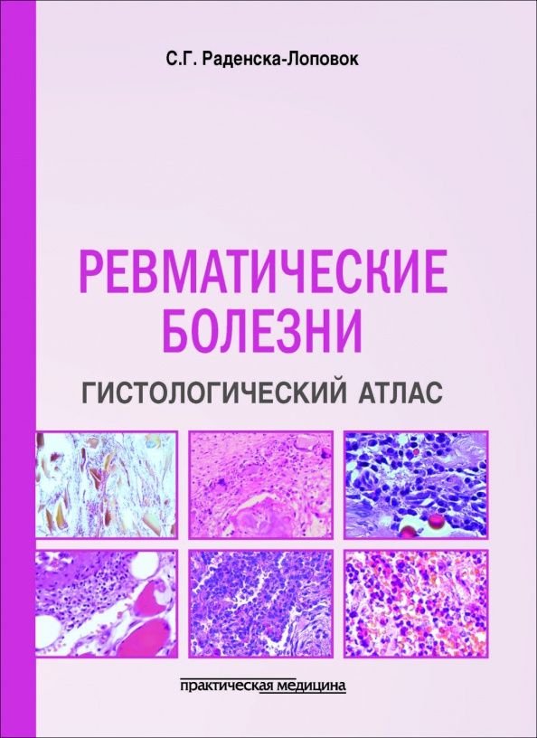 Стефка Раденска-Лоповок: Ревматические болезни. Гистологический атлас