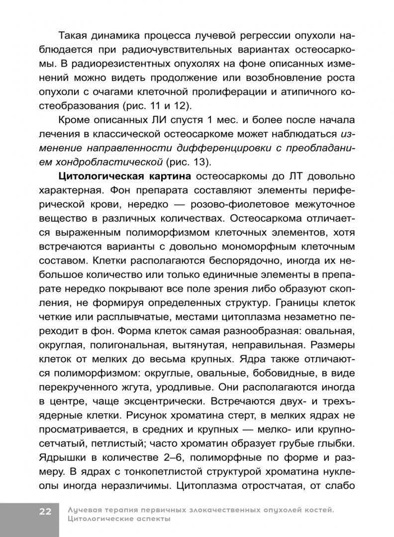 Наталья Полонская: Лучевая терапия первичных злокачественных опухолей костей. Цитологические аспекты