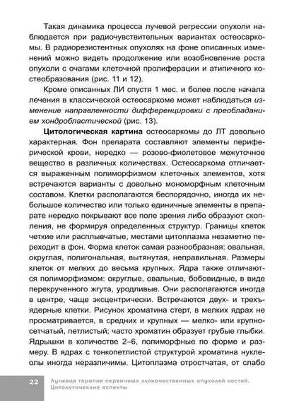 Наталья Полонская: Лучевая терапия первичных злокачественных опухолей костей. Цитологические аспекты