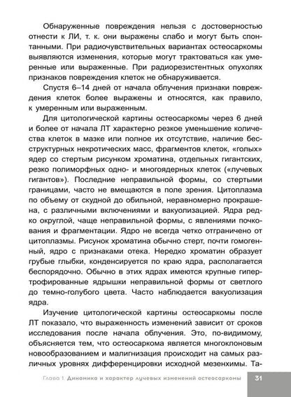 Наталья Полонская: Лучевая терапия первичных злокачественных опухолей костей. Цитологические аспекты