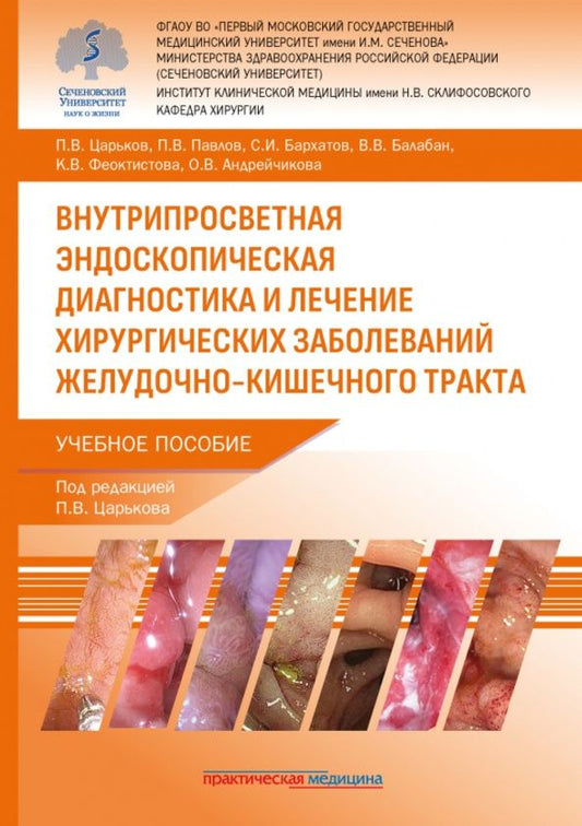 Павел Павлов: Внутрипросветная эндоскопическая диагностика и лечение хирургических заболеваний ЖКТ