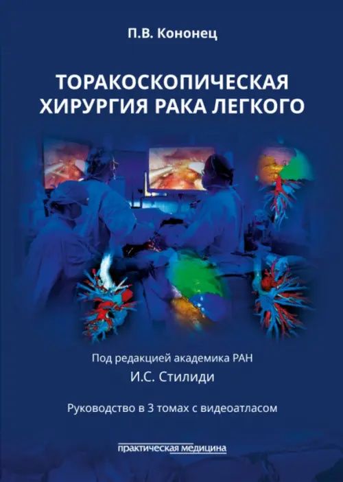 Павел Кононец: Торакоскопическая хирургия рака легкого