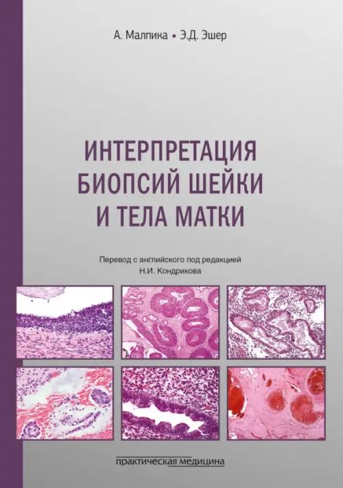 Анаис Малпика: Интерпретация биопсий шейки и тела матки