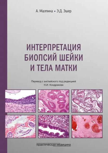 Анаис Малпика: Интерпретация биопсий шейки и тела матки