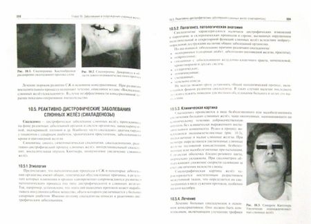 Фотография книги "Афанасьев, Абдусаламов, Белолапоткова: Хирургическая стоматология. Учебник"