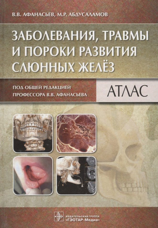 Обложка книги "Афанасьев: Заболевания, травмы и пороки развития слюнных желёз"