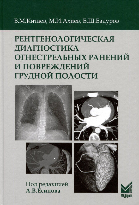 Обложка книги "Ахиев, Бадуров, Китаев: Рентгенологическая диагностика огнестрельных ранений и повреждений грудной полости"
