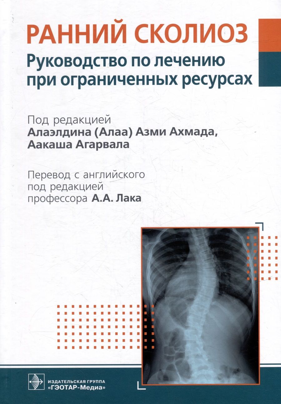 Обложка книги "Ахмад, Агарвал, Абдельгавад: Ранний сколиоз. Руководство по лечению при ограниченных ресурсах"