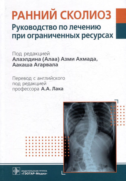 Обложка книги "Ахмад, Агарвал, Абдельгавад: Ранний сколиоз. Руководство по лечению при ограниченных ресурсах"