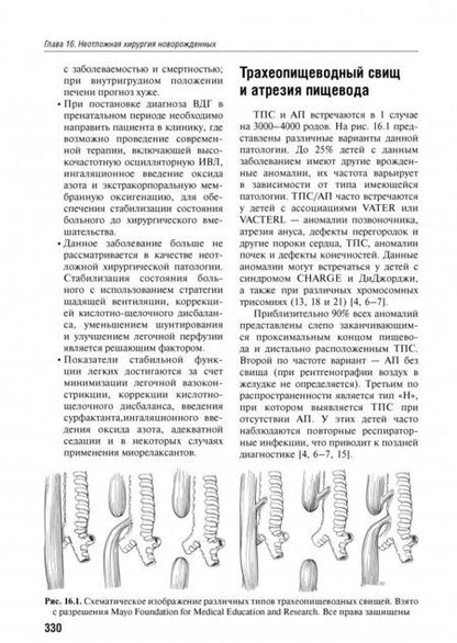 Фотография книги "Ахмад, Андерсон, Онспо: Детская анестезиология"