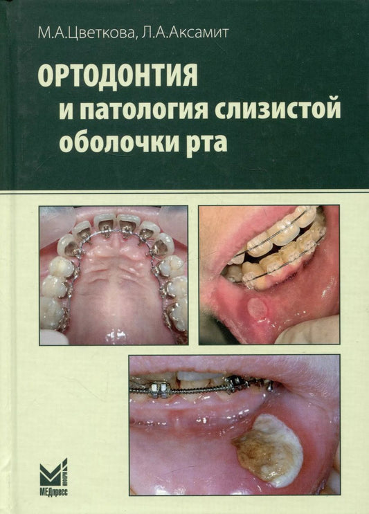 Обложка книги "Аксамит, Цветкова: Ортодонтия и патология слизистой оболочки рта"