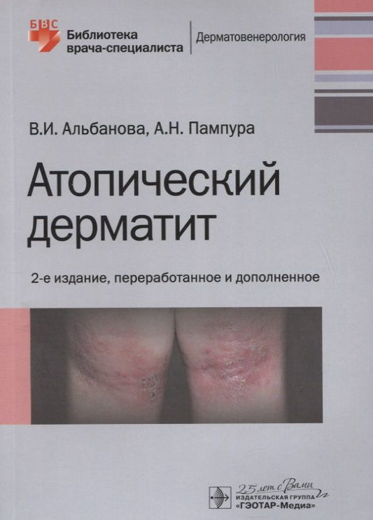 Обложка книги "Альбанова: Атопический дерматит"