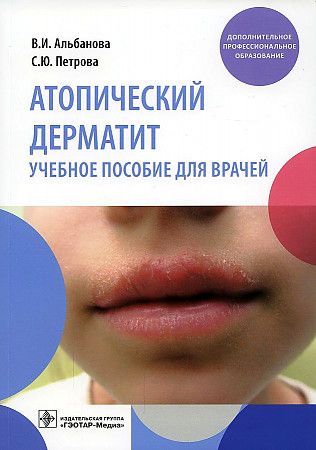 Обложка книги "Альбанова, Петрова: Атопический дерматит. Учебное пособие для врачей"