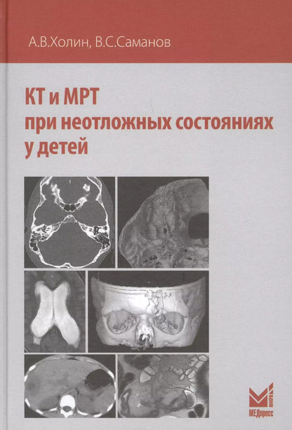Обложка книги "Александр Холин: КТ и МРТ при неотложных состояниях у детей"